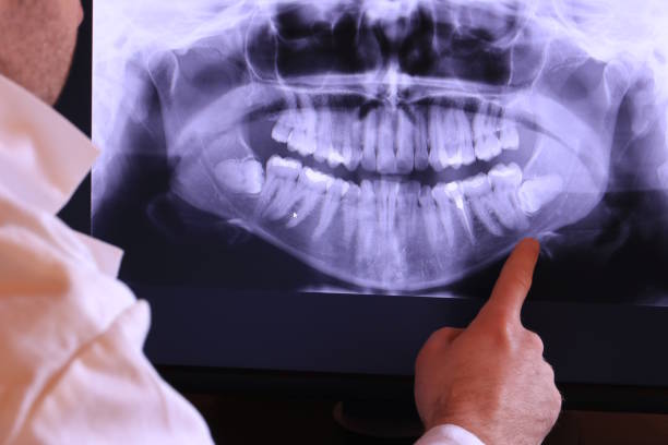 Best Broken or Cracked Tooth Emergency Dentist in Naval Academy, MD