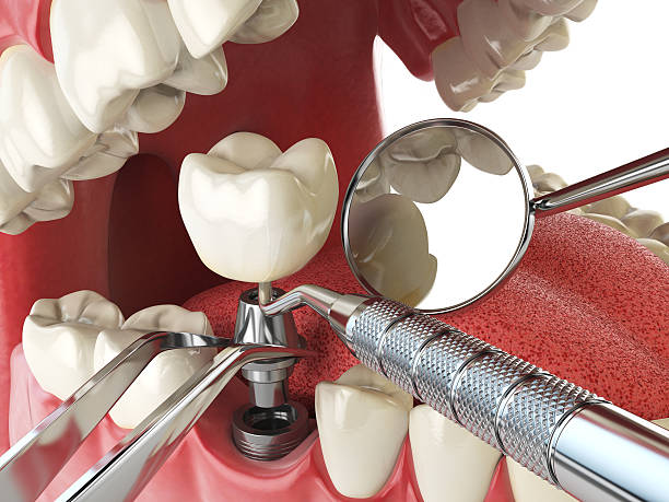 Best 24-Hour Emergency Dentist in Naval Academy, MD